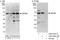 Zinc Finger And BTB Domain Containing 9 antibody, A303-243A, Bethyl Labs, Immunoprecipitation image 