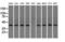 Sterol O-Acyltransferase 2 antibody, LS-C115249, Lifespan Biosciences, Western Blot image 