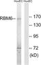 RNA Binding Motif Protein 6 antibody, GTX87044, GeneTex, Western Blot image 