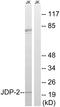 Jun dimerization protein 2 antibody, LS-C199155, Lifespan Biosciences, Western Blot image 