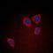 Progesterone Receptor antibody, orb214389, Biorbyt, Immunofluorescence image 