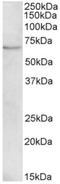 Peroxisomal carnitine O-octanoyltransferase antibody, AP32804PU-N, Origene, Western Blot image 