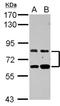 Zinc finger protein 64 antibody, NBP2-20945, Novus Biologicals, Western Blot image 