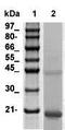 Natriuretic Peptide B antibody, TA354578, Origene, Western Blot image 