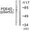 cAMP-specific 3 ,5 -cyclic phosphodiesterase 4D antibody, LS-C199417, Lifespan Biosciences, Western Blot image 