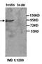 Piwi-like protein 1 antibody, orb77271, Biorbyt, Western Blot image 