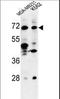 Thrombospondin Type Laminin G Domain And EAR Repeats antibody, LS-C203646, Lifespan Biosciences, Western Blot image 