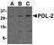 Programmed Cell Death 1 Ligand 2 antibody, orb74810, Biorbyt, Western Blot image 