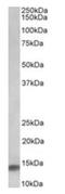 NADH:Ubiquinone Oxidoreductase Subunit A7 antibody, orb43521, Biorbyt, Western Blot image 