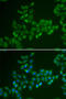 Carnitine O-Acetyltransferase antibody, 22-161, ProSci, Immunofluorescence image 
