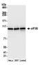 Eukaryotic Translation Initiation Factor 3 Subunit B antibody, A301-761A, Bethyl Labs, Western Blot image 