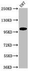 Leucine-rich repeat-containing G-protein coupled receptor 6 antibody, CSB-PA884515LA01HU, Cusabio, Western Blot image 