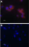 Transient Receptor Potential Cation Channel Subfamily V Member 5 antibody, GTX54868, GeneTex, Immunocytochemistry image 