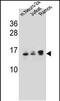 Ubiquitin-conjugating enzyme E2 E2 antibody, PA5-48639, Invitrogen Antibodies, Western Blot image 