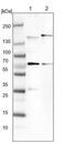 NBR1 Autophagy Cargo Receptor antibody, PA5-54660, Invitrogen Antibodies, Western Blot image 