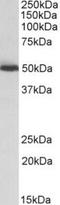 Aldehyde Dehydrogenase 2 Family Member antibody, TA311134, Origene, Western Blot image 