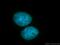 RNA-binding motif, single-stranded-interacting protein 1 antibody, 11061-2-AP, Proteintech Group, Immunofluorescence image 