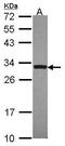 TNF Receptor Superfamily Member 6b antibody, GTX114109, GeneTex, Western Blot image 