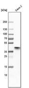 Distal-Less Homeobox 5 antibody, NBP1-85793, Novus Biologicals, Western Blot image 