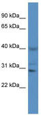 Cathepsin S antibody, TA343088, Origene, Western Blot image 