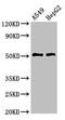 Tyrosine Aminotransferase antibody, LS-C671310, Lifespan Biosciences, Western Blot image 