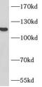 ATP Citrate Lyase antibody, FNab00687, FineTest, Western Blot image 