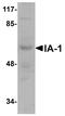 INSM Transcriptional Repressor 1 antibody, A05005, Boster Biological Technology, Western Blot image 