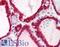 Stromal Interaction Molecule 1 antibody, LS-B1880, Lifespan Biosciences, Immunohistochemistry frozen image 