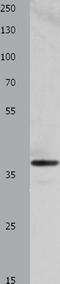 Heme Oxygenase 2 antibody, TA323816, Origene, Western Blot image 