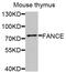 FA Complementation Group E antibody, PA5-76383, Invitrogen Antibodies, Western Blot image 