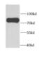 Serine/threonine-protein kinase PAK 6 antibody, FNab06124, FineTest, Western Blot image 