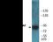B-Raf Proto-Oncogene, Serine/Threonine Kinase antibody, EKC2192, Boster Biological Technology, Western Blot image 