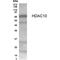 Histone deacetylase 10 antibody, PA1-23496, Invitrogen Antibodies, Western Blot image 