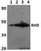 Rh Blood Group D Antigen antibody, LS-C412190, Lifespan Biosciences, Western Blot image 
