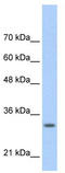 MAF BZIP Transcription Factor B antibody, TA334223, Origene, Western Blot image 