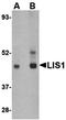 Platelet-activating factor acetylhydrolase IB subunit alpha antibody, orb74864, Biorbyt, Western Blot image 