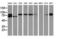 Catenin Beta 1 antibody, LS-C337248, Lifespan Biosciences, Western Blot image 