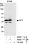 Microtubule-associated protein RP/EB family member 2 antibody, A302-713A, Bethyl Labs, Immunoprecipitation image 