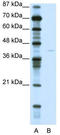 Potassium Voltage-Gated Channel Subfamily A Member 7 antibody, TA338715, Origene, Western Blot image 