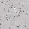 Cerebellar Degeneration Related Protein 2 antibody, PA5-53741, Invitrogen Antibodies, Immunohistochemistry frozen image 