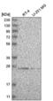 HscB Mitochondrial Iron-Sulfur Cluster Cochaperone antibody, NBP2-54997, Novus Biologicals, Western Blot image 