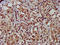 Dimethyladenosine transferase 1, mitochondrial antibody, LS-C672810, Lifespan Biosciences, Immunohistochemistry paraffin image 