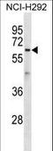 Atlastin GTPase 1 antibody, LS-C156629, Lifespan Biosciences, Western Blot image 