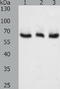 Tyrosinase antibody, TA323680, Origene, Western Blot image 