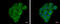Follicle-stimulating hormone receptor antibody, GTX108202, GeneTex, Immunocytochemistry image 