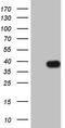 Insulin Like Growth Factor Binding Protein 1 antibody, TA808733, Origene, Western Blot image 