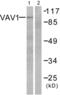 Vav Guanine Nucleotide Exchange Factor 1 antibody, abx012888, Abbexa, Western Blot image 