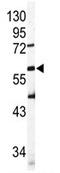 Sialic Acid Binding Ig Like Lectin 6 antibody, AP11628PU-N, Origene, Western Blot image 