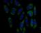F-Box Protein 5 antibody, NBP2-76833, Novus Biologicals, Immunocytochemistry image 