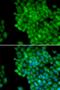 Melanoma-associated antigen 1 antibody, orb167376, Biorbyt, Immunofluorescence image 